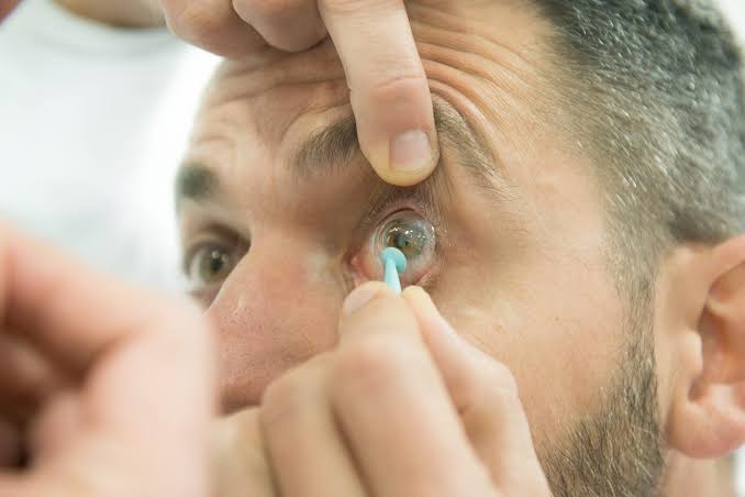 Cómo poner, quitar y limpiar tus lentes esclerales
