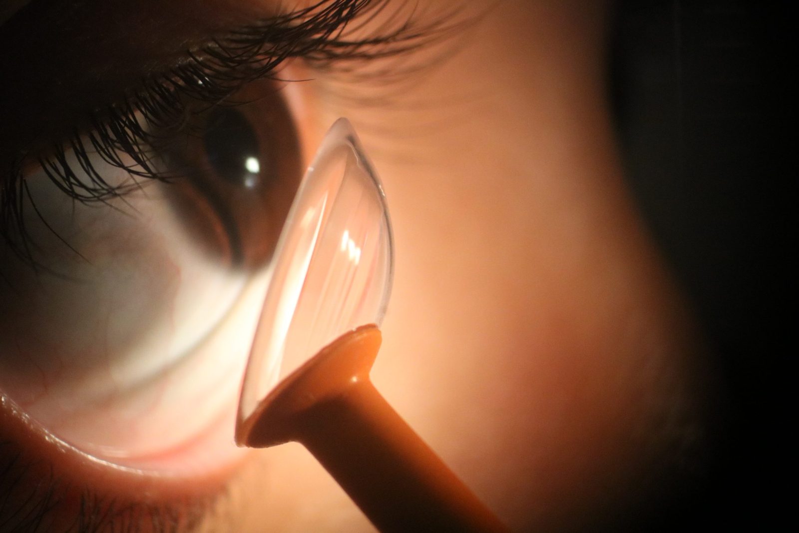 ¿Qué son los lentes esclerales y para quién son?